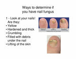 Nail Fungus Treatment For Toe and Finger Nail Fungal Infections #1 Natural Cure